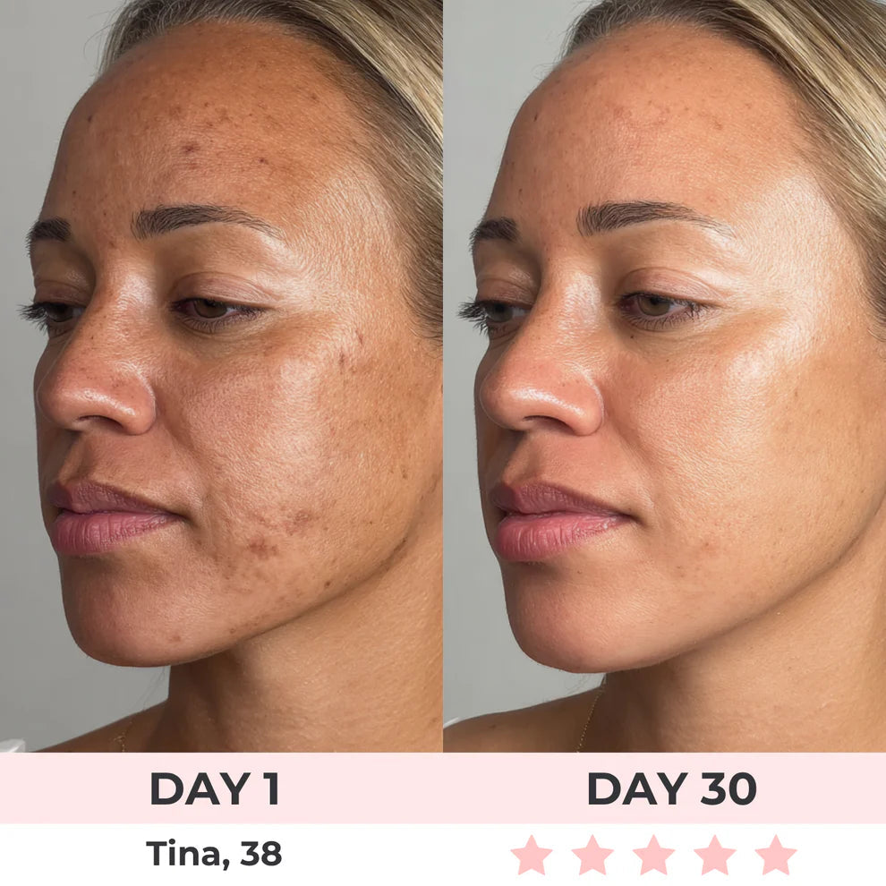 Stressed Skin? Let’s Give It a Tropical Hug.